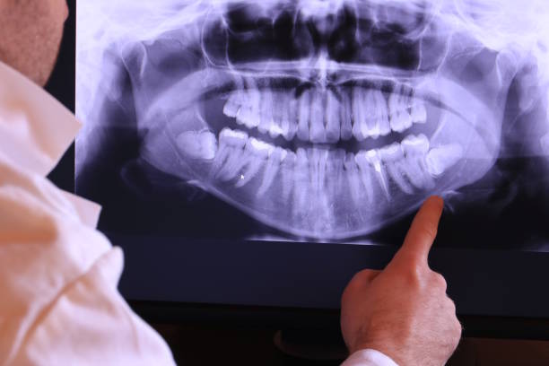 Best Tooth Pain Emergency Relief  in Fort Mill, SC